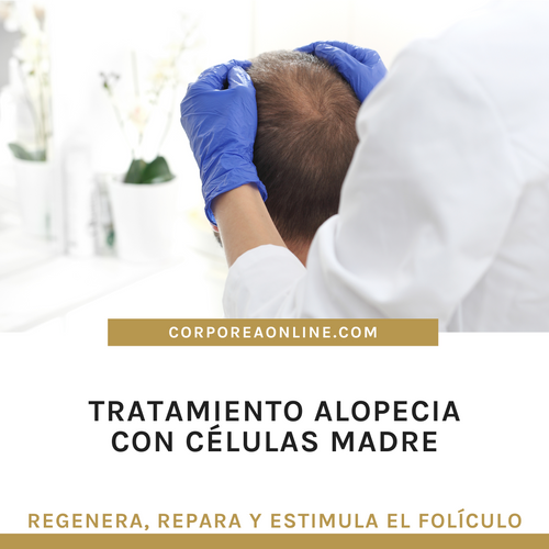Tratamiento para alopecia con células madre
