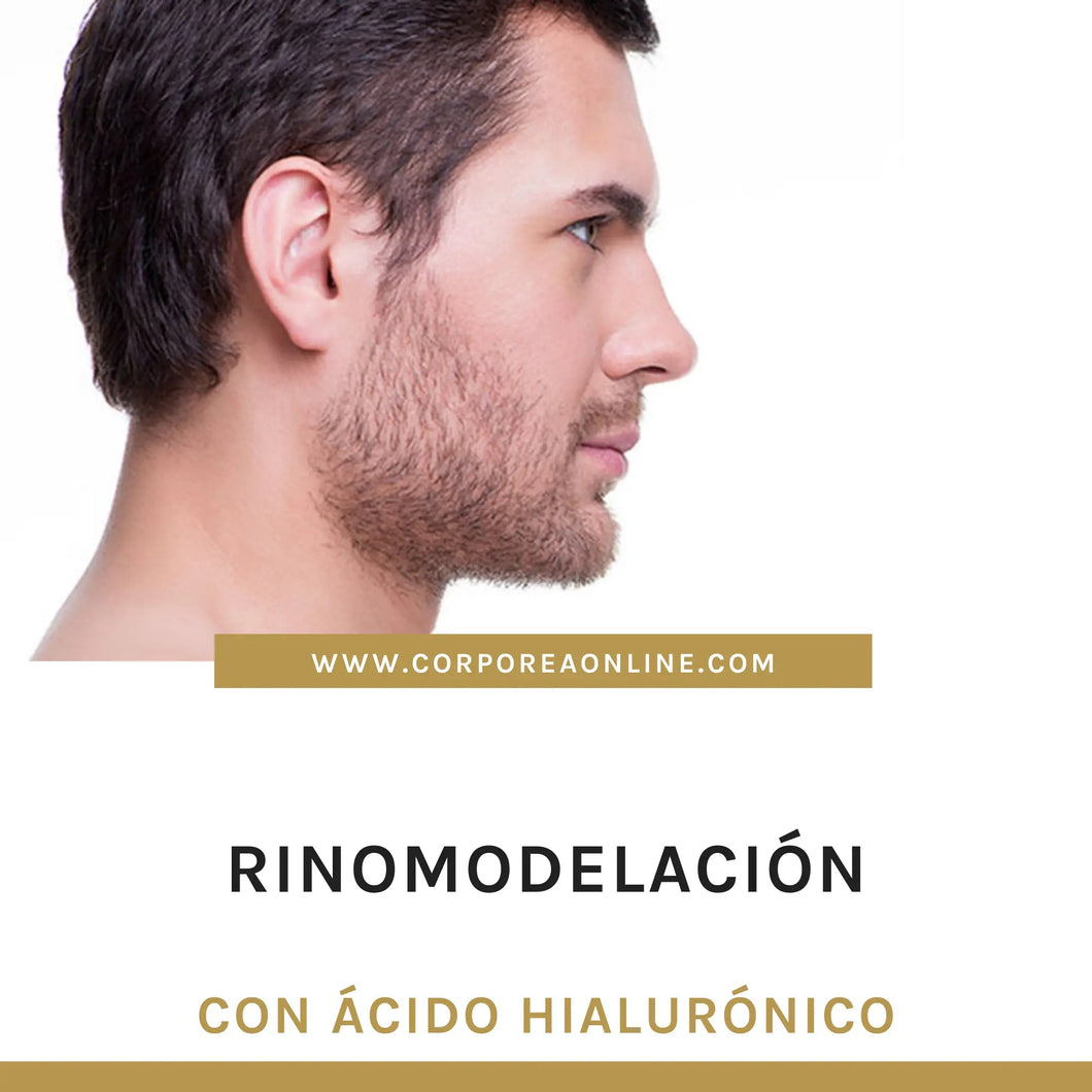 Rinomodelación con ácido hialurónico (AH) - Medicina Estetica